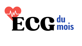 ECG du mois